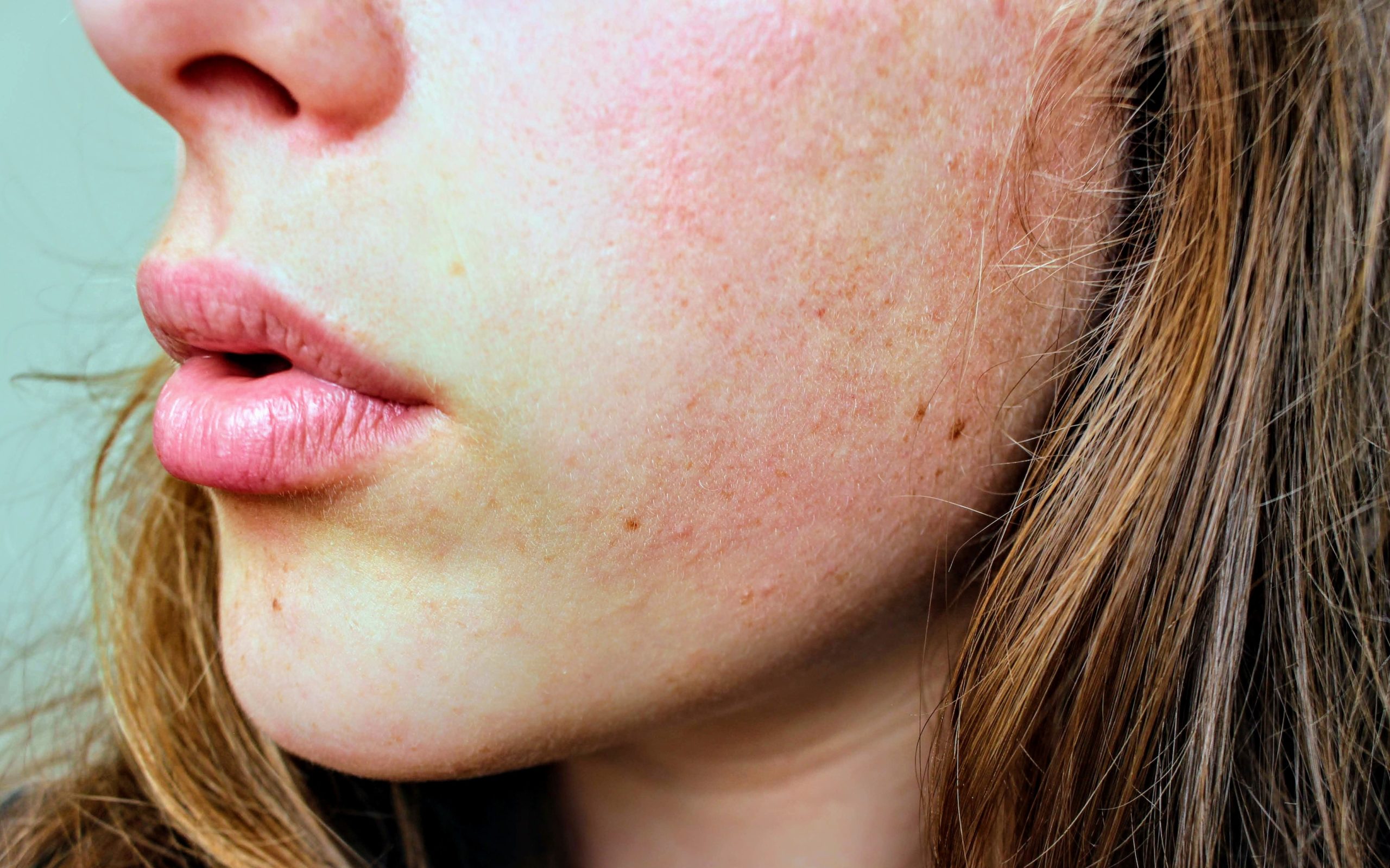 Top 10 mặt nạ cho da khô nhạy cảm: Dưỡng ẩm da tuyệt vời